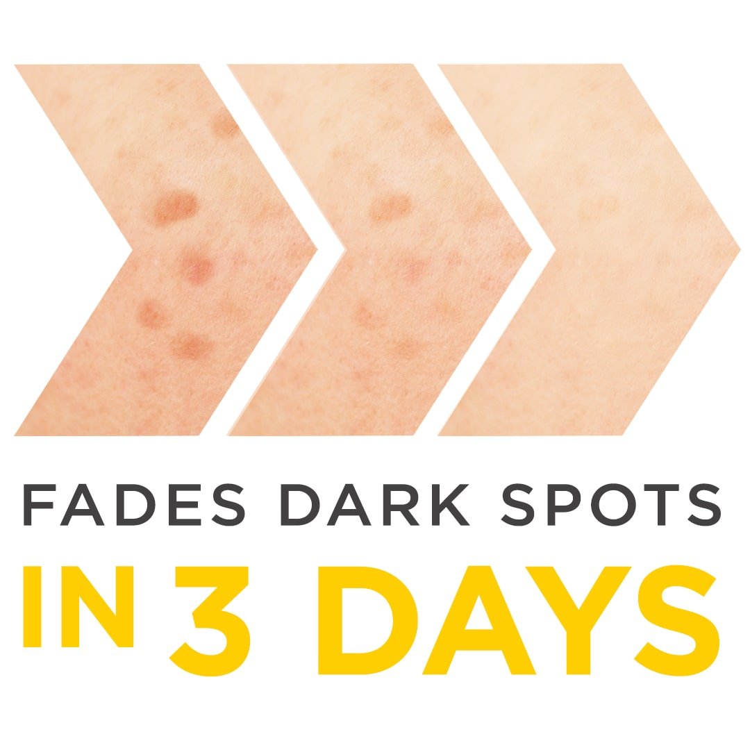 Fades Dark Spots in 3 Days